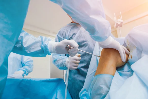 Arthroscopy